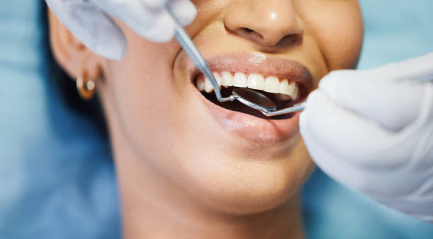 Best Emergency Tooth Extraction in Vandenberg Village, CA