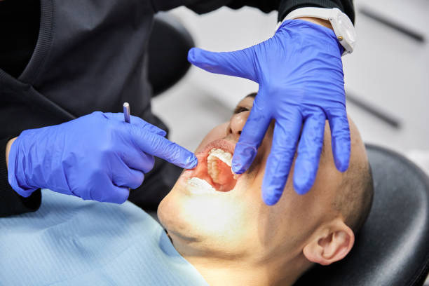 Best Emergency Tooth Extraction in Vandenberg Village, CA