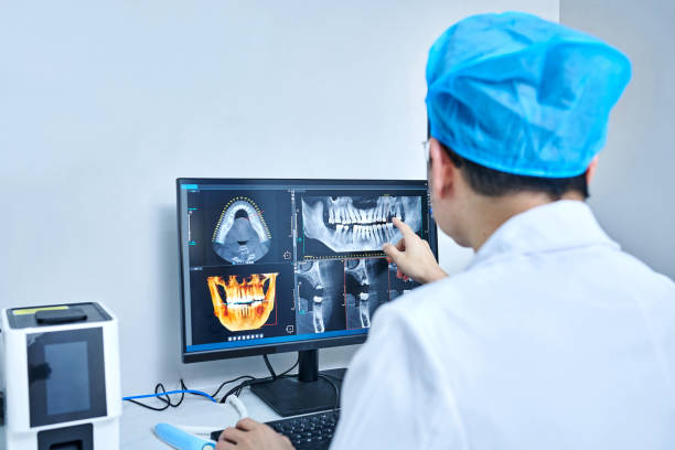 Best Emergency Wisdom Teeth Removal in Vandenberg Village, CA